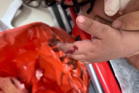 1 yaşındaki bebek parmağını vantilatöre kaptırdı, uzmanlar uyardı: “1 ayda 4-5 hastamız oldu”