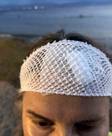 Denizde yüzerken jet ski çarptı, ölümden döndü