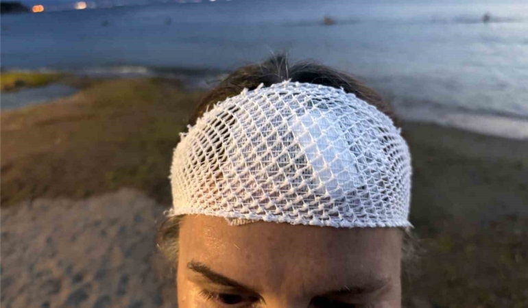 Denizde yüzerken jet ski çarptı, ölümden döndü