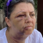 Küçükçekmece’de kedi besleyen iki kız kardeşi komşularının saldırısına uğradı