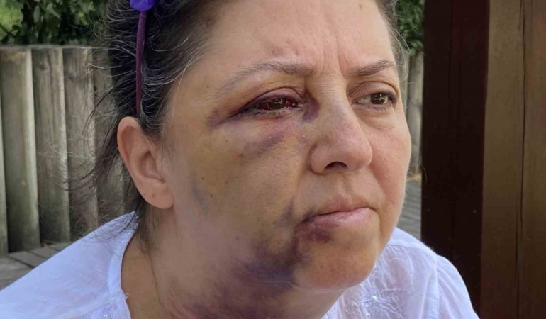 Küçükçekmece’de kedi besleyen iki kız kardeşi komşularının saldırısına uğradı