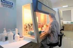 Yakın Doğu Üniversitesi maymun çiçeğini tespit eden kit geliştirdi