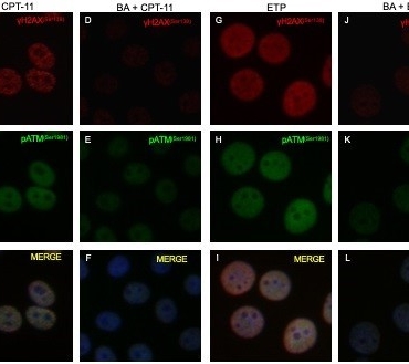BUÜ’lü akademisyenin projesine TÜSEB desteği