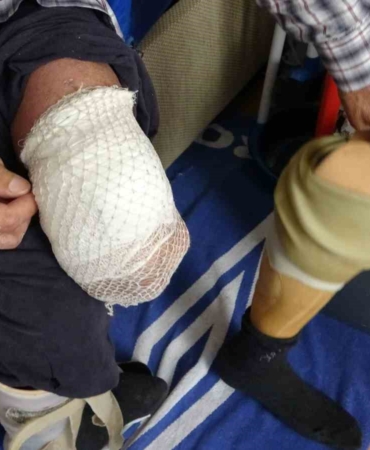 Bir zamanlar mahallenin neşesiydi şimdi evden dışarı çıkamıyor