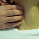 Boynunuzdaki şişliği göz ardı etmeyin