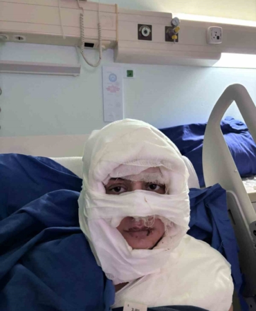 Kadıköy’de akıl almaz olay: Genç kadın başka bir kadın tarafından ateşe verildi