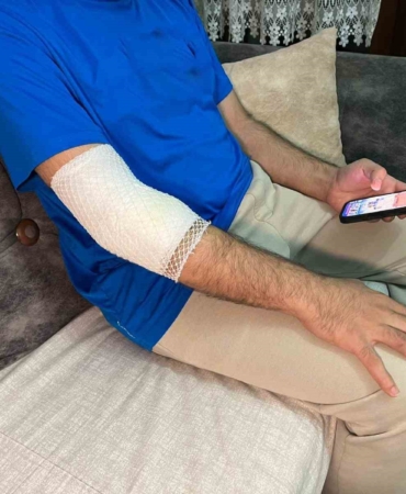 Başakşehir’de sitenin güvenlik görevlisine sahipli köpek saldırdı