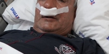 65 yaşındaki adamın burnundan 100 gramlık taş çıkarıldı