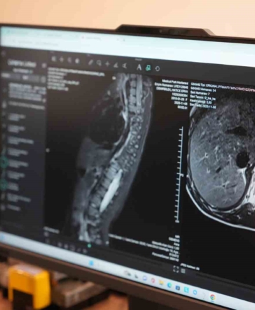 Sinsi ilerleyen bu rahatsızlığı ilk fark eden anneler oluyor