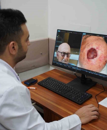 Dünyada 3’üncü kez rastlandı: Saçlı derideki nadir tümör Sakarya’da tedavi edildi