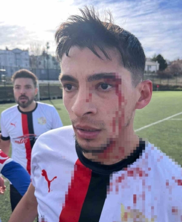 Maç sonrası saha içi savaş alanına döndü, 3 futbolcu hastanelik oldu