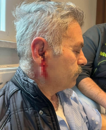 Silivri’de özel bakım merkezine çağrılan eski çalışan darbedildi