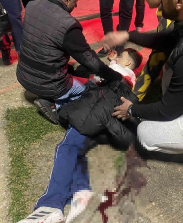 Bursa’da parkta bıçaklı kavga: 16 yaşındaki çocuk yaralandı