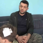 Yalova’daki komşu kavgasında bu kez 8 yaşındaki çocuğa taşlı saldırı