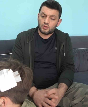 Yalova’daki komşu kavgasında bu kez 8 yaşındaki çocuğa taşlı saldırı