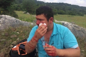 Gazeteciyi öldüresiye dövmüşlerdi, tanık "Yere düştüler" dedi