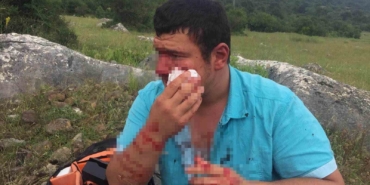 Gazeteciyi öldüresiye dövmüşlerdi, tanık "Yere düştüler" dedi