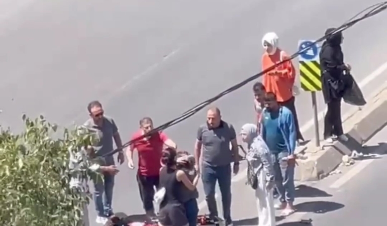 Kaza yaptı, kendini unuttu motosikletine üzüldü