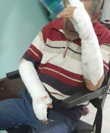 Manyas’ta köpeklerin saldırısına uğrayan bir kişi feci şekilde yaralandı