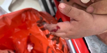 1 yaşındaki bebek parmağını vantilatöre kaptırdı, uzmanlar uyardı: “1 ayda 4-5 hastamız oldu”