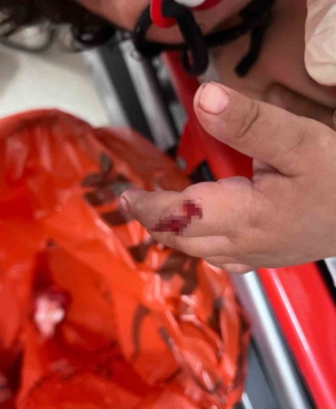 1 yaşındaki bebek parmağını vantilatöre kaptırdı, uzmanlar uyardı: “1 ayda 4-5 hastamız oldu”