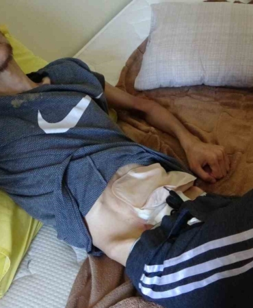 20 yaşındaki Suriyeli hasta, kayıt probleminden dolayı tedavisine devam edemiyor