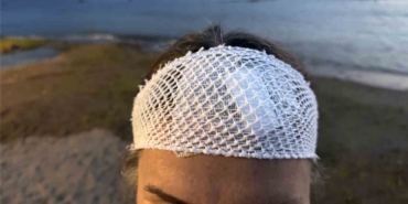 Denizde yüzerken jet ski çarptı, ölümden döndü