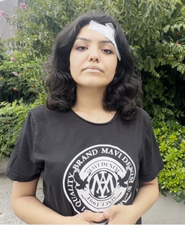 İstanbul’da eğlence mekanında saldırıya uğrayan fenomen kız konuştu