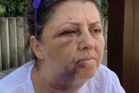 Küçükçekmece’de kedi besleyen iki kız kardeşi komşularının saldırısına uğradı