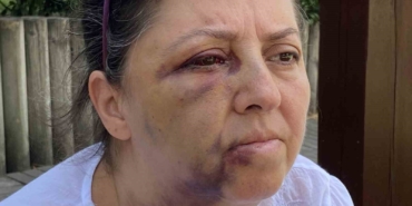 Küçükçekmece’de kedi besleyen iki kız kardeşi komşularının saldırısına uğradı