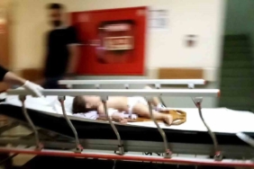 Bursa’da 3. kattan düşen 1 yaşındaki bebek ağır yaralandı