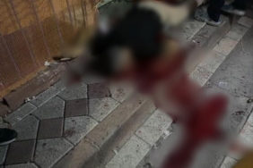 Sultangazi’de silahlı saldırıya uğrayan kuyumcu hayatını kaybetti