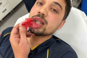 Bursa’da ambulans şoförü darp edildi