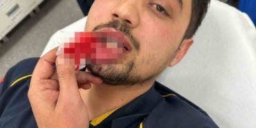 Bursa’da ambulans şoförü darp edildi