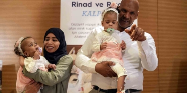 Cezayirli yapışık ikizler Türkiye’de yapılan operasyonla ayrıldı