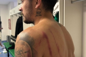 Kocaelispor’dan açıklama: "4’ü futbolcu, 6 kişi yaralandı"