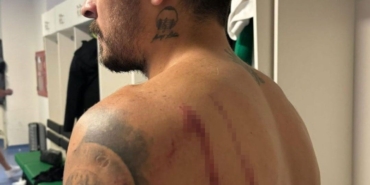 Kocaelispor’dan açıklama: "4’ü futbolcu, 6 kişi yaralandı"