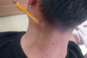 Park yeri kavgası esnasında boynuna tornavida saplandı