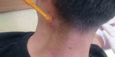 Park yeri kavgası esnasında boynuna tornavida saplandı