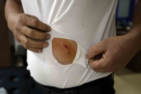 Çerkezköy’de fabrika işçisi köpeklerin saldırısından yara bere içinde kurtuldu