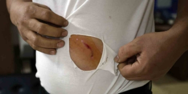 Çerkezköy’de fabrika işçisi köpeklerin saldırısından yara bere içinde kurtuldu