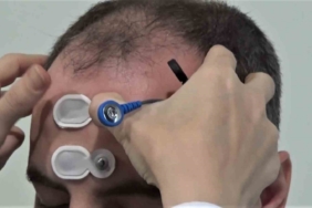 Gemlik Devlet Hastanesinde işitme hastaları için yeni hizmet devreye girdi