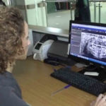 Engelli kişiler ile dişçi fobisi olan çocuklara genel anestezi altında tedavi