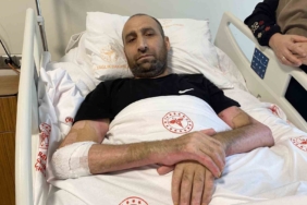 Mangal yapmak isterken ’Tiner faciası’: Vücudunun yüzde 80’i yandı, patlamanın şiddeti kameraya yansıdı