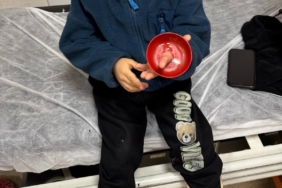 Parmağına zil çanı sıkışan çocuk için seferberlik