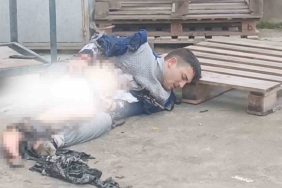 Sobaya tiner döktü, yaralandı