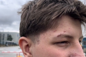 Transpaletin altında kalan öğrenci konuştu: “Normalde benim alanım değil ama beni oraya görevlendirdiler”