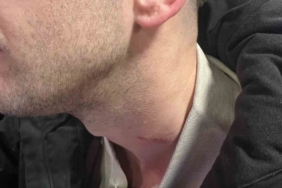 Yeşil saha boks ringine döndü