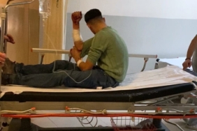 Kavga edenleri ayırmak isterken bıçakla yaralandı