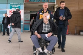 Boya tüpü patladı yaşlı adam gözünden yaralandı